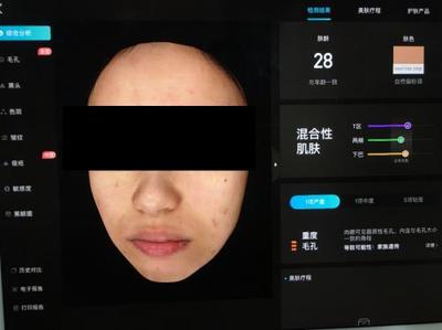 皮膚檢測(cè)儀哪家強(qiáng)?Visia、美圖宜膚、A-one實(shí)測(cè)