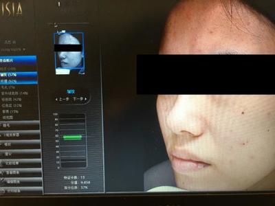 皮膚檢測(cè)儀哪家強(qiáng)？Visia、美圖宜膚、A-one實(shí)測(cè)深度對(duì)比